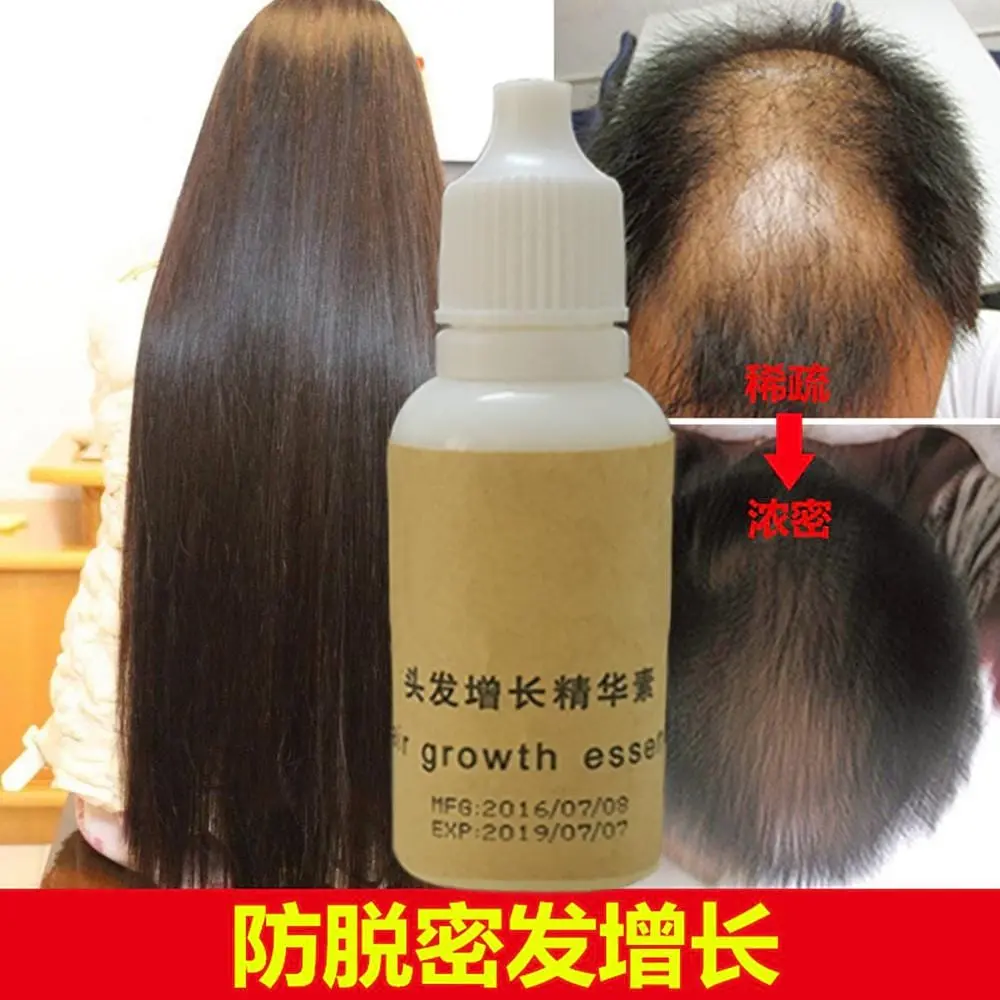 Andrea Hair Growth Professional Salon Hairstyles Keratin Hair Care Styling Anti Hair Loss Dense Sunburst Better Than Twnce 1